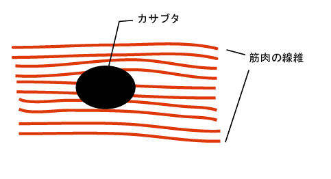 筋線維とカサブタ